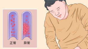 VTE的危害您了解嗎？