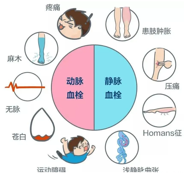 2022世界血栓日：就醫(yī)有新路，血栓找介入