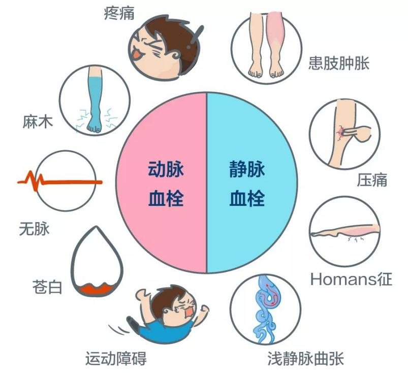 深靜脈血栓能致命，防治“大法”要了解！